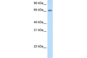 Western Blotting (WB) image for anti-Adenosine Deaminase, tRNA-Specific 1 (ADAT1) antibody (ABIN2462241) (ADAT1 antibody)