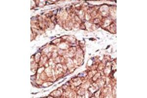 Image no. 2 for anti-Toll-Like Receptor 5 (TLR5) (N-Term) antibody (ABIN357051) (TLR5 antibody  (N-Term))