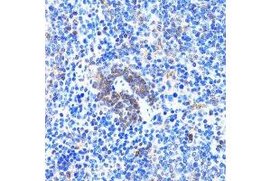 Immunohistochemistry (Paraffin-embedded Sections) (IHC (p)) image for anti-Actin-Related Protein 2 (ACTR2) (AA 1-160) antibody (ABIN6136493)