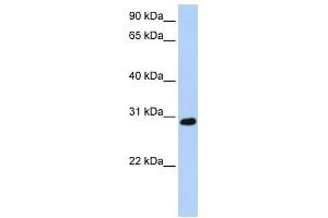 WB Suggested Anti-XBP1 Antibody Titration: 0. (XBP1 antibody  (C-Term))