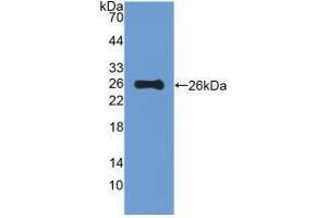 Western blot analysis of recombinant Mouse MUC5B. (MUC5B antibody  (AA 75-295))