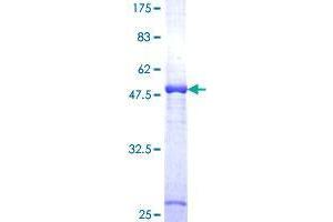 DCXR Protein (AA 1-244) (GST tag)