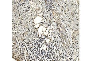 IHC analysis of Aldolase/ALDOA using anti-Aldolase/ALDOA antibody (ABIN7601908). (ALDOA antibody  (AA 50-364))