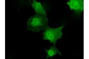 Anti-TKT mouse monoclonal antibody (ABIN2453725) immunofluorescent staining of COS7 cells transiently transfected by pCMV6-ENTRY TKT (RC203497). (TKT antibody)
