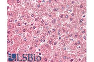 ABIN571255 (5µg/ml) staining of paraffin embedded Human Liver. (ALDH6A1 antibody  (AA 262-272))