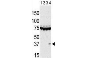 Western blot testing of Aurora-C antibody and lysate of 293 cells expressing 1) Flag tag, 2) Flag-tagged -A, 3) -B and 4) Aurora-C. (Aurora Kinase C antibody  (AA 115-145))