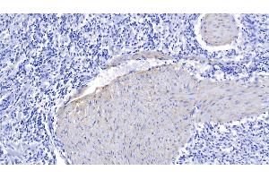 Detection of ELN in Human Spleen Tissue using Polyclonal Antibody to Elastin (ELN) (Elastin antibody  (AA 392-645))