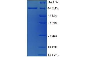 SDS-PAGE (SDS) image for Cysteine Conjugate-beta Lyase 2 (CCBL2) (AA 1-454), (full length) protein (His-SUMO Tag) (ABIN5711433) (CCBL2 Protein (AA 1-454, full length) (His-SUMO Tag))