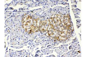 Immunohistochemistry (IHC) image for anti-Insulin-Like Growth Factor Binding Protein 1 (IGFBPI) (AA 26-272) antibody (ABIN5519002)