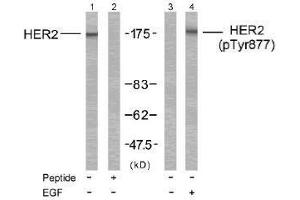 Image no. 2 for anti-Receptor tyrosine-protein kinase erbB-2 (ErbB2/Her2) (Tyr877) antibody (ABIN197222) (ErbB2/Her2 antibody  (Tyr877))