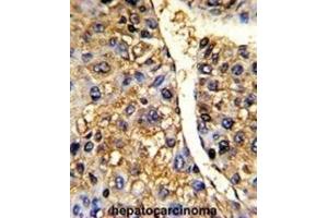 Immunohistochemistry (IHC) image for anti-Tu Translation Elongation Factor, Mitochondrial (Tufm) antibody (ABIN3001714) (TUFM antibody)