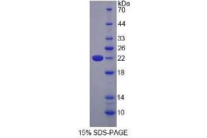 SDS-PAGE (SDS) image for Odorant Binding Protein 2A (OBP2A) (AA 20-176) protein (His tag) (ABIN4989686) (OBP2A Protein (AA 20-176) (His tag))
