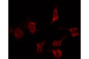 ABIN6268904 staining Hela by IF/ICC. (Cyclin F antibody  (C-Term))