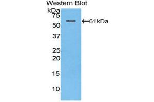 Western blot analysis of the recombinant protein. (THBS4 antibody  (AA 644-925))