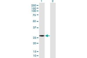 Western Blot analysis of C4orf43 expression in transfected 293T cell line by C4orf43 MaxPab polyclonal antibody. (C4orf43 antibody  (AA 1-203))