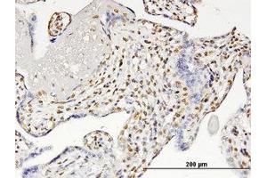 Image no. 1 for anti-Runt-Related Transcription Factor 2 (RUNX2) (AA 251-351) antibody (ABIN599359) (RUNX2 antibody  (AA 251-351))