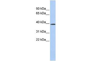 WB Suggested Anti-CLN6 Antibody Titration:  0.