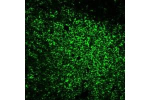 Immunofluorescence Analysis of human tonsil FFPE section stained with anti-CD45RO (UCHL-1) and goat anti-mouse HRP, detected using CF488A tyramide in Tyramide Amplification Buffer Plus. (CD45 antibody)