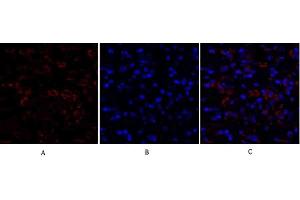 Immunofluorescence analysis of human breast cancer tissue. (Ki-67 antibody  (AA 3170-3250))