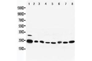 Lane 8: MM453 Cell Lysate (RAB5 antibody  (Middle Region))