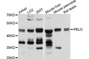 Western blot analysis of extracts of various cell lines, using PELO antibody (ABIN5972746) at 1/1000 dilution. (PELO antibody)