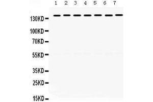 Western Blotting (WB) image for anti-Structural Maintenance of Chromosomes 3 (SMC3) (AA 1178-1216), (C-Term) antibody (ABIN3043343)