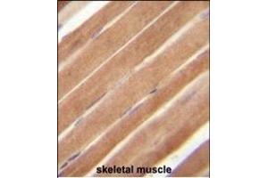 EphB2 Antibody (N-term) A immunohistochemistry analysis in formalin fixed and paraffin embedded human skeletal muscle followed by peroxidase conjugation of the secondary antibody and DAB staining. (EPH Receptor B2 antibody  (N-Term))