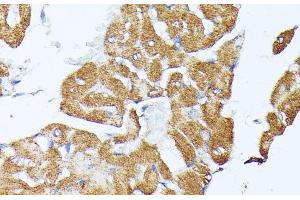 Immunohistochemistry of paraffin-embedded Rat heart using TRAP1 Polyclonal Antibody at dilution of 1:100 (40x lens). (TRAP1 antibody)