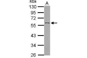 WB Image Sample (30 ug of whole cell lysate) A: HepG2 10% SDS PAGE antibody diluted at 1:1000 (ANGPTL3 antibody)