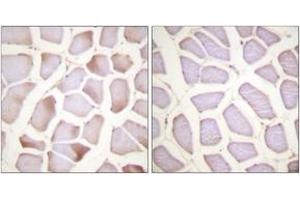 Immunohistochemistry analysis of paraffin-embedded human skeletal muscle, using TNNI3 (Phospho-Ser22+Ser23) Antibody. (TNNI3 antibody  (pSer22))