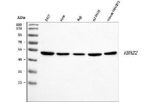 Western blot analysis of RBM22 using anti-RBM22 antibody (ABIN7600268).