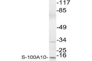 Western blot (WB) analysis of S-100A10 antibody in extracts from COLO cells. (S100A10 antibody)