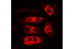 Immunofluorescent analysis of HFE staining in MCF7 cells. (HFE antibody)