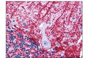 Human Brain, Cerebellum: Formalin-Fixed, Paraffin-Embedded (FFPE) (SIPA1L3 antibody  (N-Term))