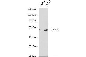 Western blot analysis of extracts of various cell lines using CYP4V2 Polyclonal Antibody at dilution of 1:1000. (CYP4V2 antibody)