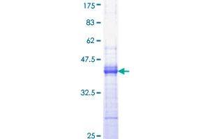Image no. 1 for Epidermal Growth Factor (EGF) (AA 926-1025) protein (GST tag) (ABIN1352425) (EGF Protein (AA 926-1025) (GST tag))