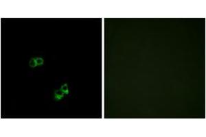 Immunofluorescence analysis of MCF7 cells, using MC5R Antibody.