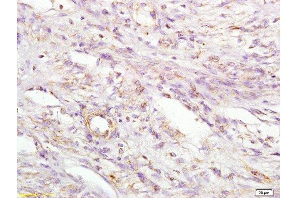MIIP antibody  (AA 251-350)