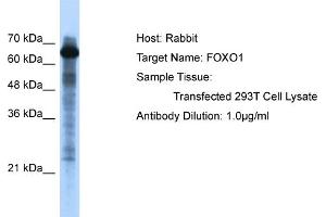 WB Suggested Anti-FOXO1 Antibody   Titration: 1. (FOXO1 antibody  (C-Term))
