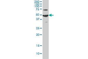 Western Blotting (WB) image for anti-Adenylate Cyclase Activating Polypeptide 1 (Pituitary) Receptor Type I (ADCYAP1R1) (AA 21-120) antibody (ABIN559786)