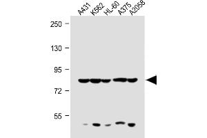 All lanes : Anti-ABCB5 Antibody (N-term) at 1:1000 dilution Lane 1: A431 whole cell lysate Lane 2: K562 whole cell lysate Lane 3: HL-60 whole cell lysate Lane 4:  whole cell lysate Lane 5:  whole cell lysate Lysates/proteins at 20 μg per lane. (ABCB5 antibody  (N-Term))
