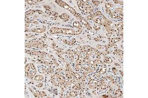 IHC analysis of SNRNP40 using anti-SNRNP40 antibody (ABIN7601719).