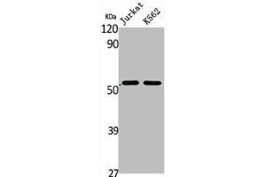 Western Blot analysis of Jurkat K562 cells using BAGE5 Polyclonal Antibody (BAG5 antibody  (N-Term))