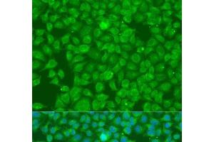 Immunofluorescence analysis of U2OS cells using SLC25A6 Polyclonal Antibody at dilution of 1:100. (SLC25A6 antibody)