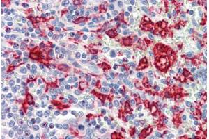 Human Spleen (formalin-fixed, paraffin-embedded) stained with HMOX1 antibody ABIN462108 at 10 ug/ml followed by biotinylated goat anti-rabbit IgG secondary antibody ABIN481713, alkaline phosphatase-streptavidin and chromogen. (HMOX1 antibody)