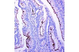 Immunohistochemistry (Paraffin-embedded Sections) (IHC (p)) image for anti-Profilin 2 (PFN2) (AA 125-140), (C-Term) antibody (ABIN3042861) (PFN2 antibody  (C-Term))