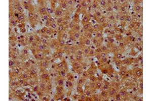 IHC image of ABIN7169368 diluted at 1:600 and staining in paraffin-embedded human liver tissue performed on a Leica BondTM system. (SAA2 antibody  (AA 19-94))