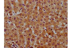 IHC image of ABIN7169368 diluted at 1:600 and staining in paraffin-embedded human liver tissue performed on a Leica BondTM system. (SAA2 antibody  (AA 19-94))