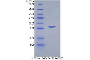 SDS-PAGE (SDS) image for Platelet/endothelial Cell Adhesion Molecule (PECAM1) ELISA Kit (ABIN6720561)