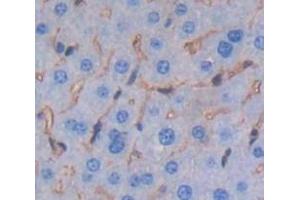 IHC-P analysis of Mouse Tissue, with DAB staining. (Lymphocyte Function Associated Antigen 2 (AA 23-203) antibody)